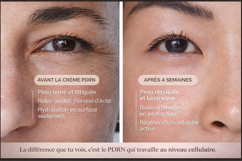 Cure 2 mois — PDRN Collagen Jelly Cream (2 pots)